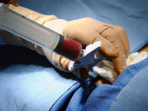 Pandemie zastavila registr dárců kostní dřeně. Loňský rok byl přitom rekordní