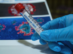 Na antigenní testy se v Karlovarském kraji zatím nelze přihlásit