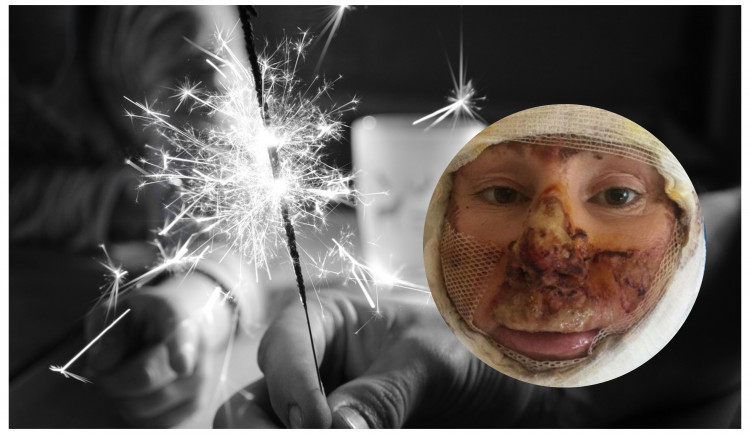 Od prskavky chytil vánoční stromek, nedopadla jsem vůbec dobře