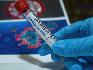 V Česku je test na koronavirus, který si může každý udělat sám
