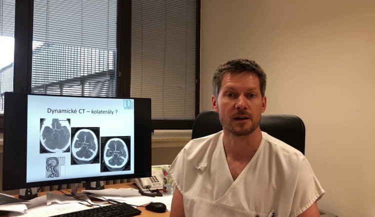 Lékař: Epilepsie není stigma, nejtěžším případům pomáhají operace