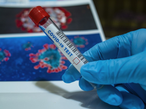 Nakažených koronavirem v Karlovarském krajem znovu přibývá, jde o desítky denně