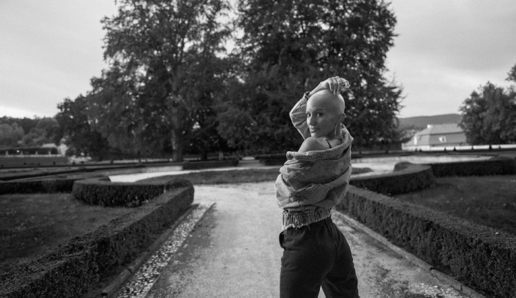 size4-16659226985806-2-behem-dvou-tydnu-jsem-prisla-o-vsechny-vlasy-pomaha-mi-o-alopecii-mluvit-rika-bara-kropackova