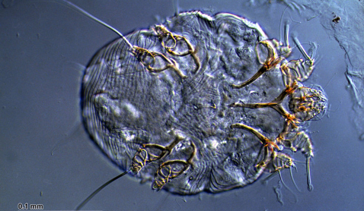 Svrab v Česku dosahuje rekordních čísel, situace v Karlovarském kraji je zatím dobrá