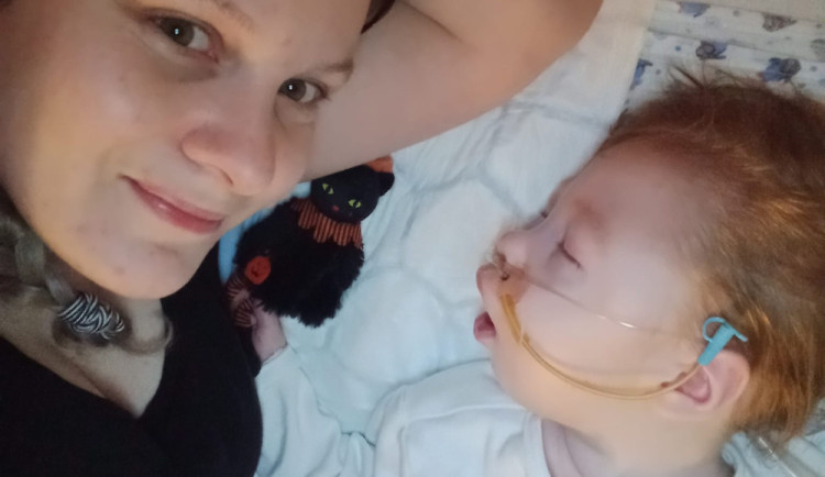Syn má poškozený mozek a nedožije se rána, řekli Tereze po porodu. Míša teď oslaví tři roky a mamince dává velkou sílu