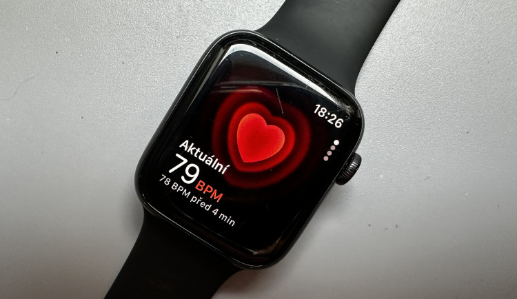 Data z nositelných zařízení, jako jsou mobily nebo chytré hodinky, mohou zlepšit výsledky i v lázeňské léčbě