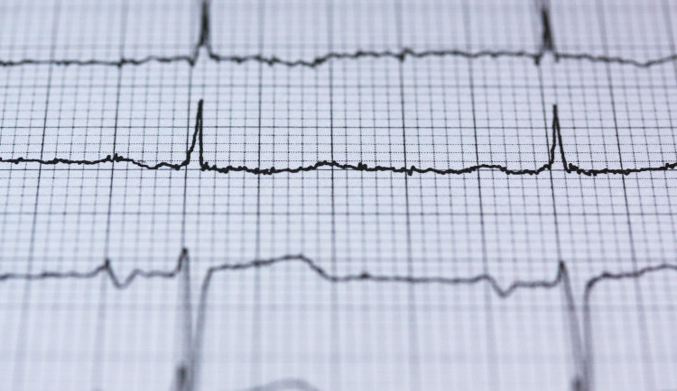 V Brně umí léčit srdce novým způsobem. Elektrodu napojí přímo k srdeční dálnici
