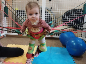 Dianka se narodila s vážnou anomálií v ústech, nemoc nemá v Česku ani pojmenování