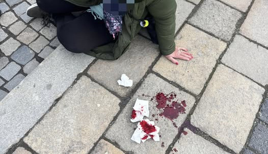 Žena v Jihlavě po pádu na obrubník dostala rychlou pomoc díky kamerám i kolemjdoucím