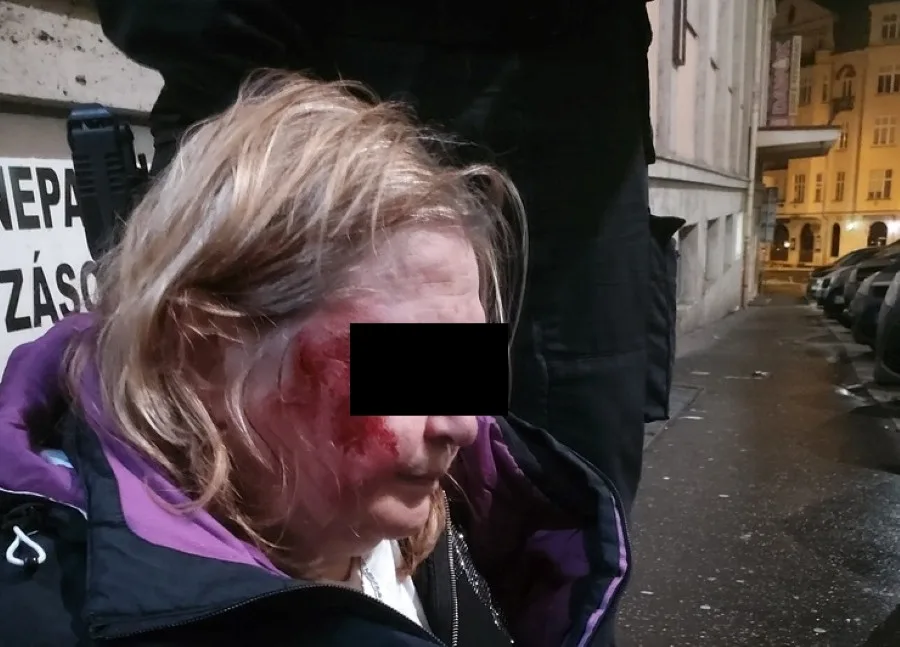Totálně opilá žena nadávala hostům i personálu restaurace, nakonec skončila na zemi s rozbitým obličejem