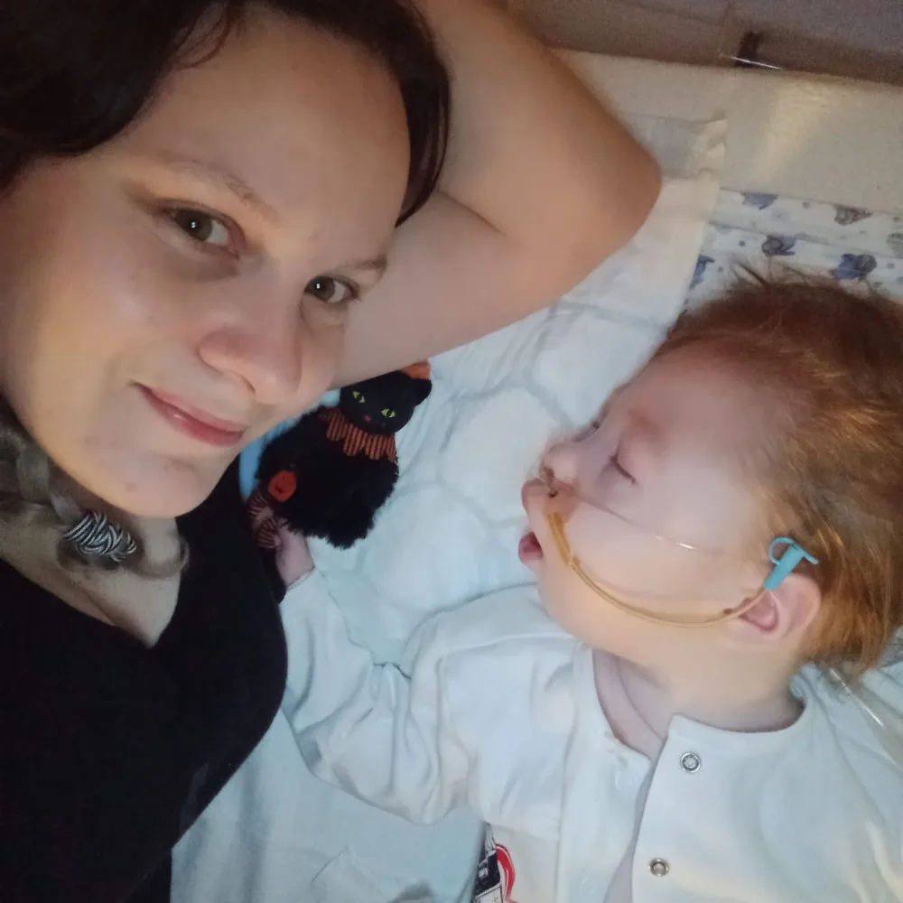 Syn má poškozený mozek a nedožije se rána, řekli Tereze po porodu. Míša teď oslaví tři roky a mamince dává velkou sílu