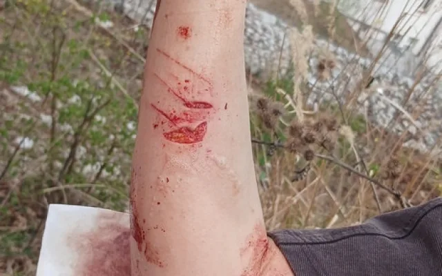 Kocour způsobil chovatelce ošklivé zranění, když se ho snažila umístit do boxu