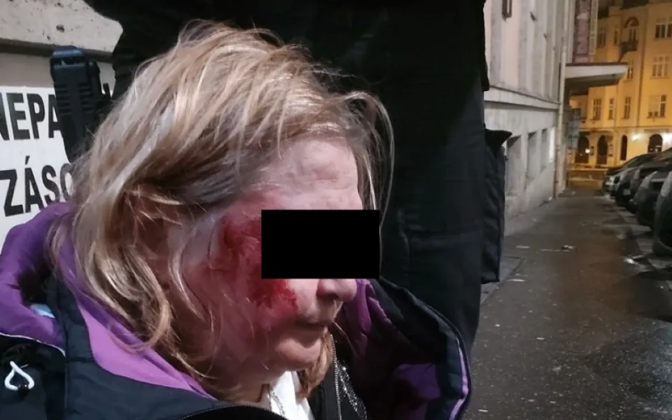 Totálně opilá žena nadávala hostům i personálu restaurace, nakonec skončila na zemi s rozbitým obličejem